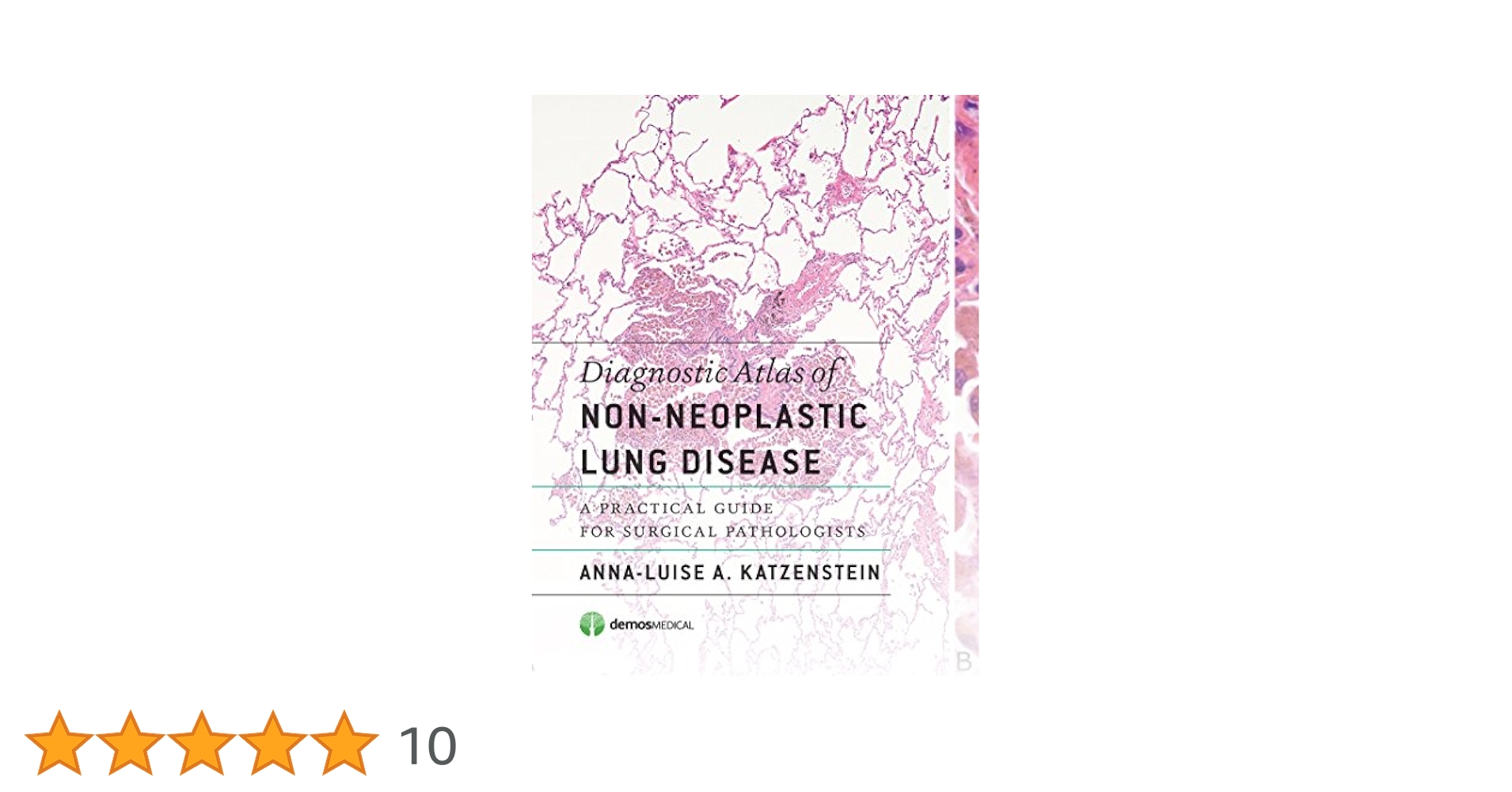 Amazon | Diagnostic Atlas of Non-Neoplastic Lung Disease: A